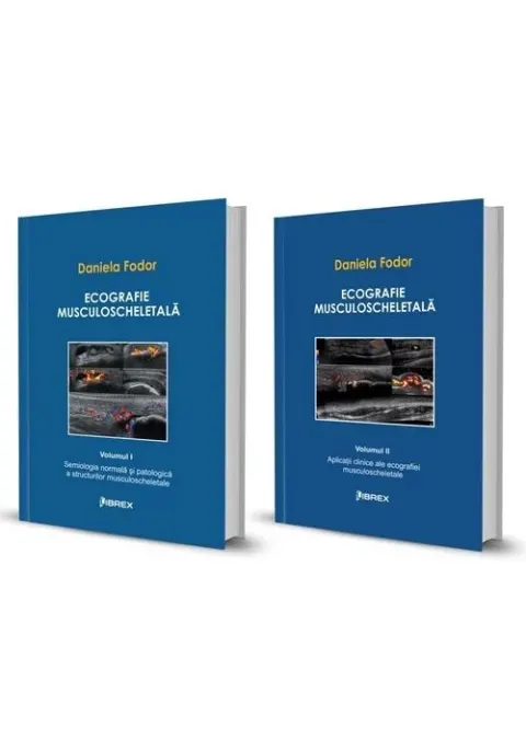 Coperta cărții Pachet Ecografie musculoscheletală - Daniela Fodor - Vol. I + Vol. II