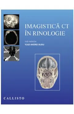 Coperta cărții Imagistica CT in rinologie