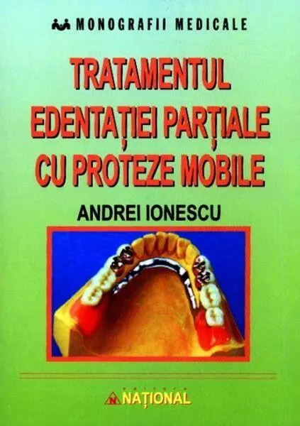 Coperta cărții Tratamentul edentației parțiale cu proteze mobile
