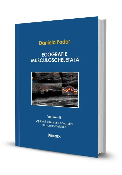 Coperta cărții Ecografie musculoscheletală - Daniela Fodor - Vol. II
