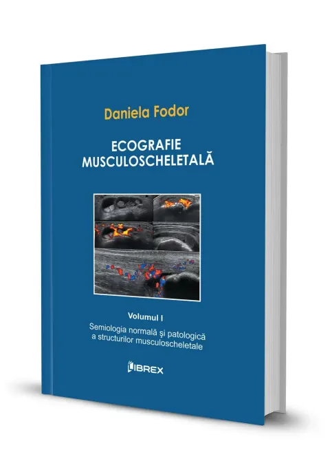 Coperta cărții Ecografie musculoscheletală - Daniela Fodor - Vol. I