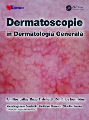 Coperta cărții Dermatoscopie in Dermatologia Generala