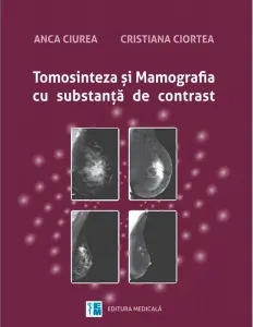 Coperta cărții Tomosinteza si mamografia cu substanta de contrast