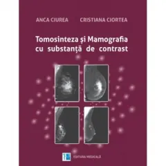 Coperta cărții Tomosinteza si mamografia cu substanta de contrast