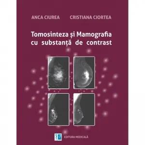 Coperta cărții Tomosinteza si mamografia cu substanta de contrast